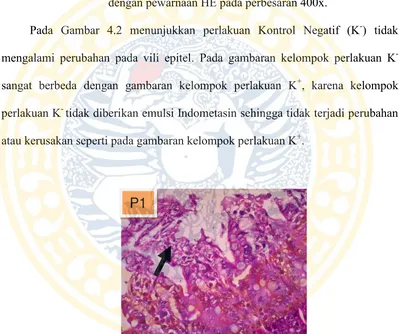 Gambar 4.2 Gambaran Histopatologi Duodenum Kontrol Negatif (K-) 
