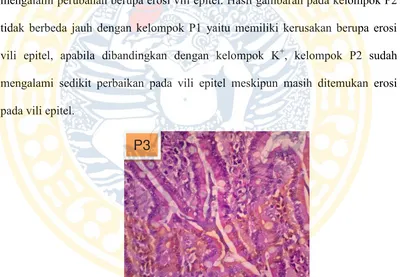 Gambar 4.4 Gambaran Histopatologi Duodenum Perlakuan Kedua (P2) 
