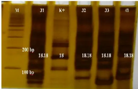 Fig. 5. Results visualization CODIS STR loci PCRresults: Thoi; 179-203 bp. (M) markers, (K +)positive control K562 allele 9 (23,31,32,33,41,42,43,51) samples