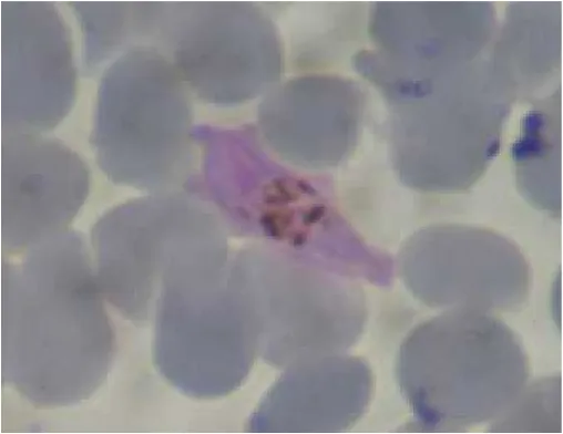 Gambar 1. Tampilan mikroskopis parasit bentuk gametosit dalam darah yang siap diambil oleh nyamukuntuk selanjutnya menjadi sporozoit di kelenjar ludah.