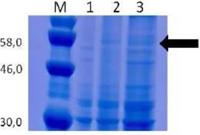 Gambar 3. Profil protein kelenjar ludah terinfeksi sporozoit P. berghei iradiasi. M, marker protein standard.