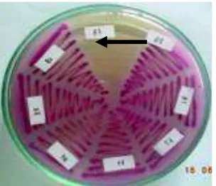 Gambar 1. Koloni  E. coli O157 (→) pada media  sorbitol macConkey agar (SMAC)  