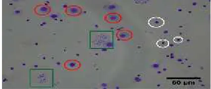 Figure 2. A microscopic view of Giemsa stanied slide thatalso containing metaphase chromosome spread (boxes),(white circles) as base for the evaluation of mitotic index of ablasts cells (red circles) and nuclei which are not countedrespondent living in HBRA (magnification of 400X).