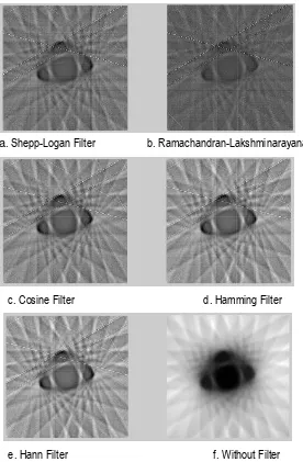 Figure 11 to 15 show the image reconstruction results for 1, 2, 4, 10 and 150on the stepper motor being used.as shown in Figure 10