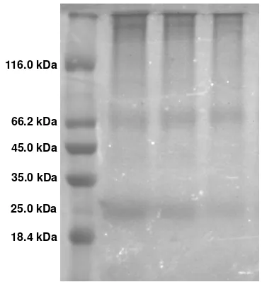 Fig. 3. The protein profile of irradiated 60 days. 20 days, lane 3 : stored for 40 days and lanes 4 : stored for                stored in liquid nitrogen
