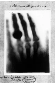 gambar tersebut terlihat jelas tulang-tulang yang ada dalam jari-jari tangan.  