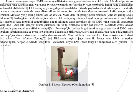 Gambar 1. Bipolar Electrode Configuration [5] 