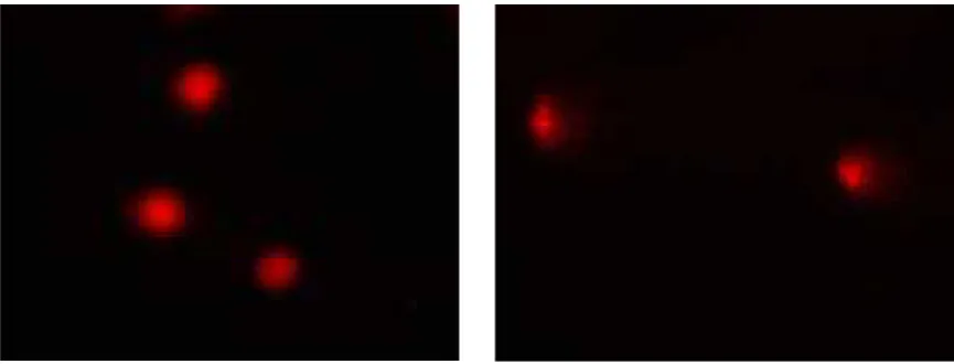 Figure 3. The results of the test visualization comet Lymphocyte cell of administration employee (left)and exposed employee (right).