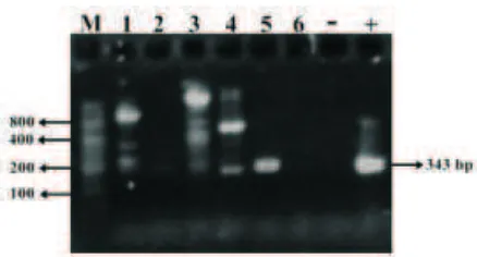 Gambar 1. Foto elektroforesis dari hasil PCRpada agarose 1%. Mulai dari kiriadalah M (Marker), hasil PCRnomor tube 1-6, kontrol negatif (-),dan kontrol positif (+).