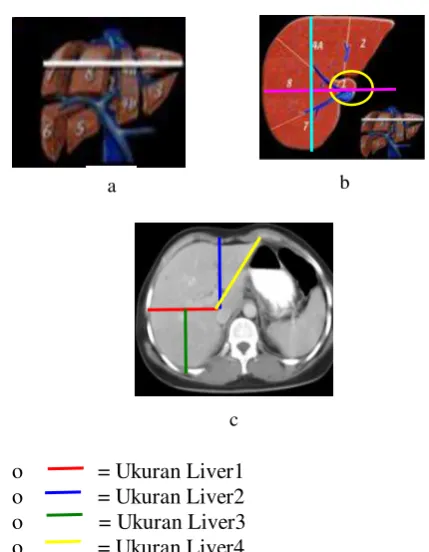 Gambar 4. Citra Liver. (a) Bentuk Liver,     