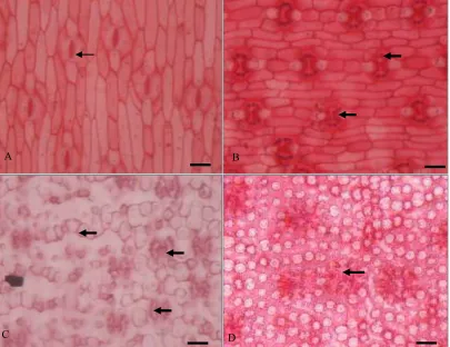 Fig. 2. Variation of stoma in Pandanus spp. There are 1st type unspecified stomata (A), 2nd type (B), 3rd type (C) and 4th type of stomata (D)