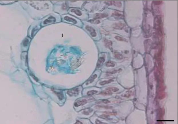 Fig. 3. Cross section of Pandanus leaf. Leaf with branched parenchyma (stellate) exist between 2 vascular bundles (above), when get mature leaf, it will form pseudolacuna (below)