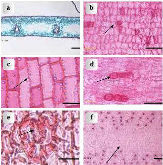 Figure 1. Light micrographs of leaves: (a) Transverse leaf section of P. multifurcatus Fagerl.; (b) Squarish abaxial    epidermal cells of P