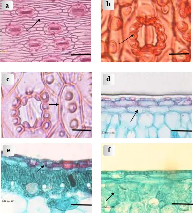 Figure 2.  Light micrographs of leaves: (a) Abaxial epidermal cells of P. dubius Spreng.; (b) Abaxial papillae in lateral subsidiary cells of P