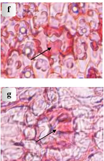 Figure 3. Light micrographs of leaves: (a) Sclerenchyma in spongy tissue of P. tectorius Parkinson cv