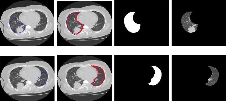 Figure 2. ASM Segmentation Process. Upper:From Left to Right is Right Lung Segmentation, Bottom: From Left to Right is Left Lung Segmentation 