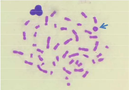 Figure 1. A ring chromosome (arrow) induced by gamma rays was found in a sample of this experiment