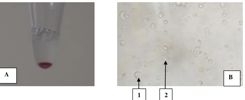 Figure 1. Issolation of circulated-PGCs of KUB chicken using buffer lysis ACK method. A) Blood sample collected from 14-18 stadium of embryonic development