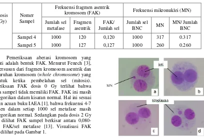 Gambar 1. Fragmen asentrik kromosom (FAK)  pada sampel radiasi dosis 2 Gy pada perbesaran 1000x 