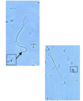 Figure 4. Integrity of plasma membrane of dairy cattle spermatozoa. (a) circle tail, good plasma membrane; (b) straight tail, damage plasma membrane