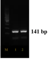 Figure 2. Visualization of PCR product amplified with annealing temperature of 62°C 15 seconds and yielded a product of 141 bp while according to (Hidayat et al