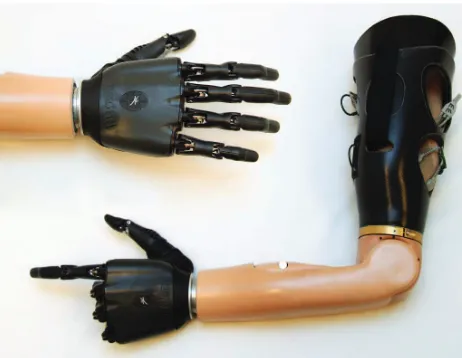 Figure 1. An example of a commercially available myoelectric prosthesis with multiple joints and functions