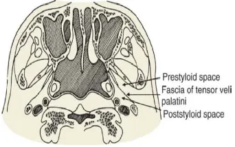 Figure 4. The fascia of the tensor veli palatini muscle divides the parapharyngeal space into a prestyloid and a poststyloid compartment.2  