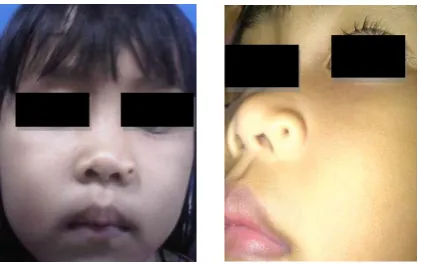 Gambar 3. Pra operasi