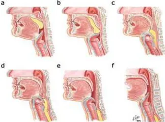 Gambar 1. Fase-fase menelan. a: fase oral, b-c: fase faring, d-f: fase esofagus.1