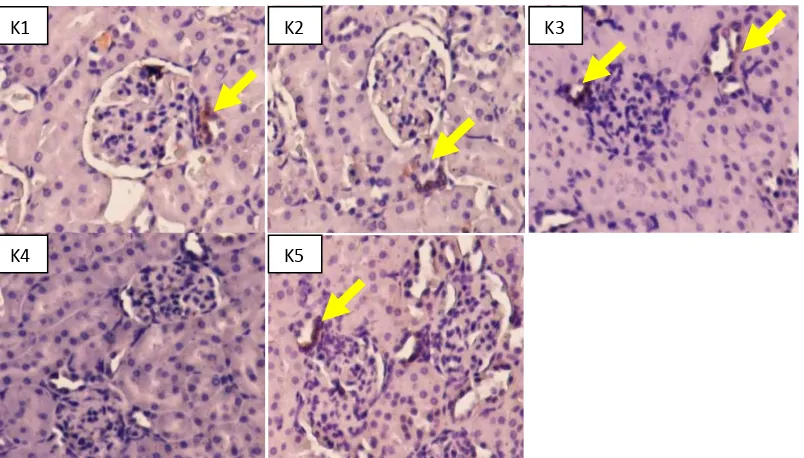 Gambar 1. Rata-rata tekanan darah sistolik (TDS)  & Persentasi Ekspresi COX-2 di sel macula densa ginjal setelah pemberian kembali asupan 