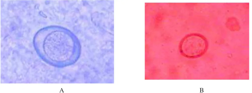 Gambar 1. Ookista Isospora felis dengan pembesaran 10x10 (A) dan Isospora rivolta dengan 