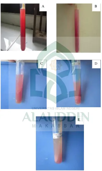 Gambar 3. Kultur Bakteri dari Tiap sampel feses dari probandus A,B,C,D,E