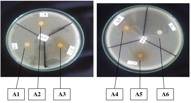 Gambar 2. Foto hasil uji daya hambat antibakteri ekstrak daun kemangi (Ocimum sanctum L) pada bakteri Propionibacterium acnes 