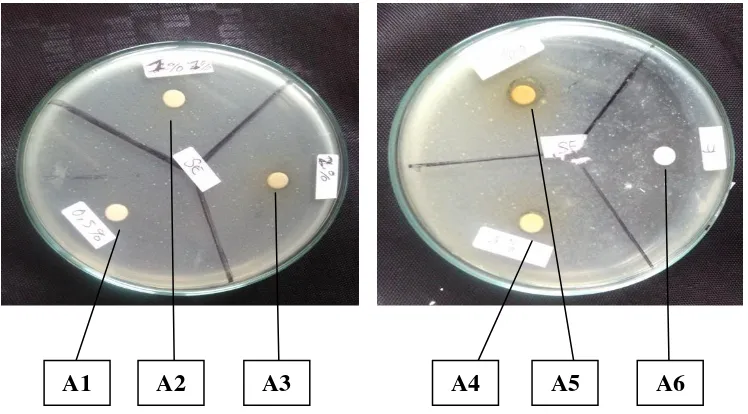 Gambar 4. Foto hasil uji daya hambat antibakteri ekstrak daun kemangi (Ocimum sanctum L) pada bakteri Staphylococcus epidermidis 