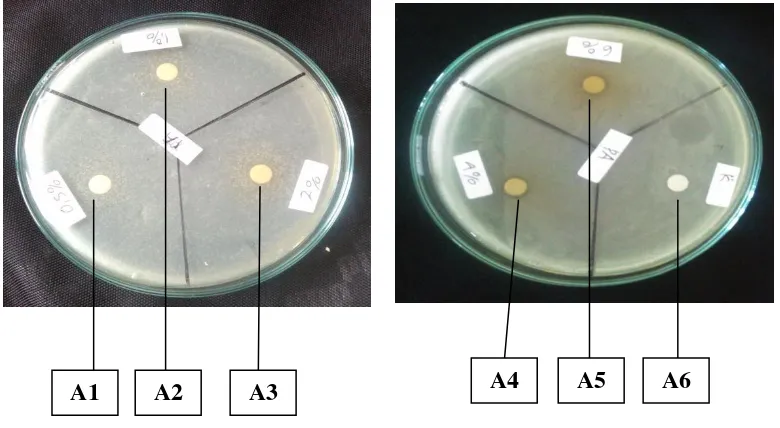 Gambar 5. Foto hasil uji daya hambat antibakteri ekstrak daun kemangi (Ocimum sanctum L) pada bakteri Pseudomonas aeruginosa 