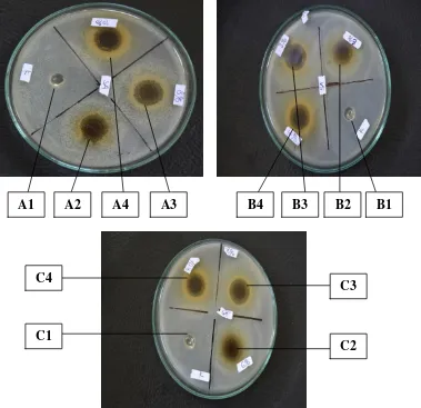Gambar 7. Foto hasil uji daya hambat gel ekstrak daun kemangi (Ocimum sanctum L) terhadap bakteri Staphylococcus aureus 