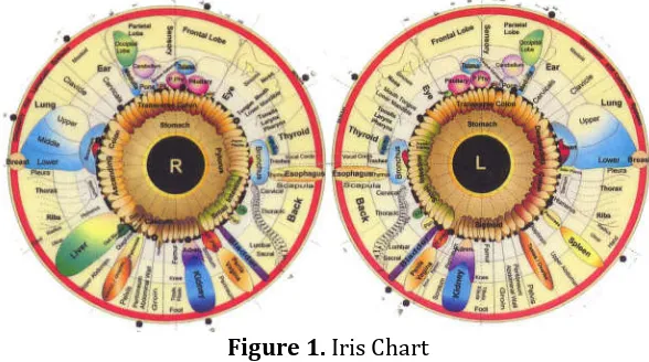 Figure 1. Iris Chart  