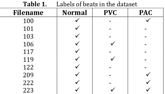 Table 1.  Labels of beats in the dataset 