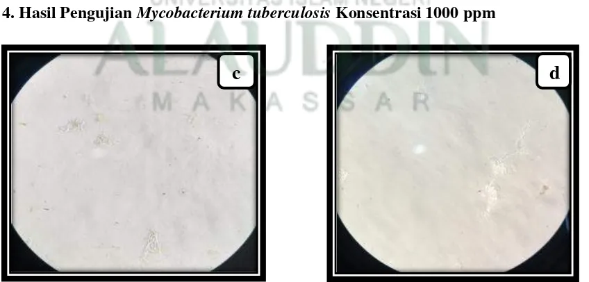 Gambar 5.Hasil pengujian Mycobacterium tuberculosis 