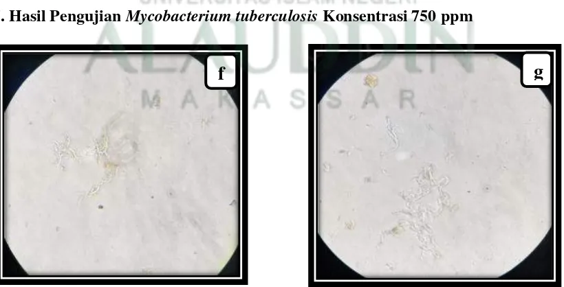 Gambar 6.Hasil Pengujian Mycobacterium tuberculosis Konsentrasi 1000 ppm 