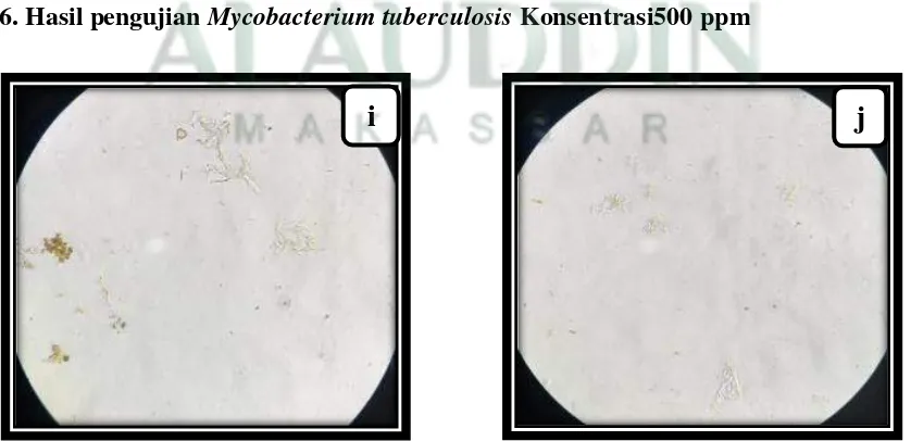 Gambar 7.Hasil Pengujian Mycobacterium tuberculosis Konsentrasi 750 ppm 