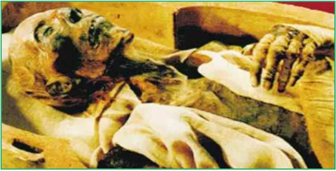 Gambar 11.2 Mummi mayat Fir’aun
