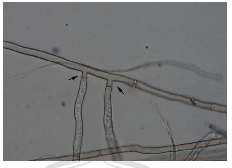 Gambar 2.1 Penampak Mikroskopis Kapang Rhizoctonia solani 