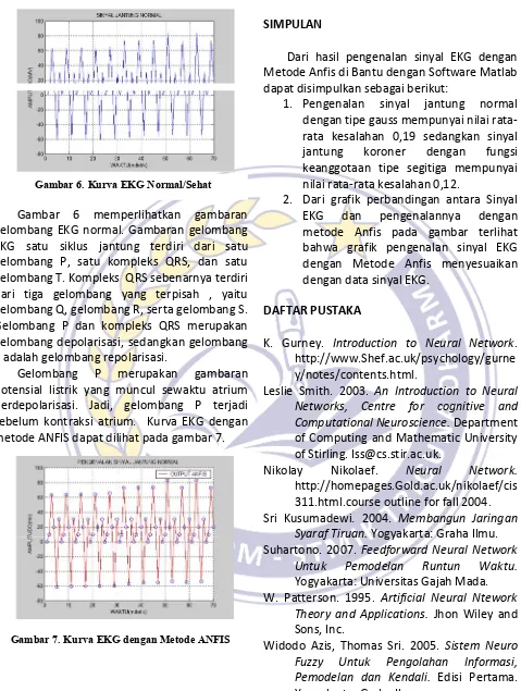 Gambar 7. Kurva EKG dengan Metode ANFIS