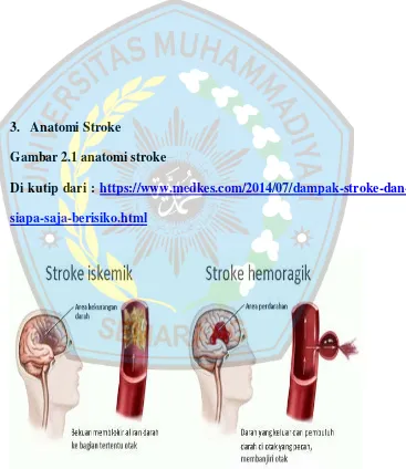 Gambar 2.1 anatomi stroke 