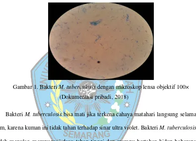 Gambar 1. Bakteri M. tuberculosis dengan mikroskop lensa objektif 100× 