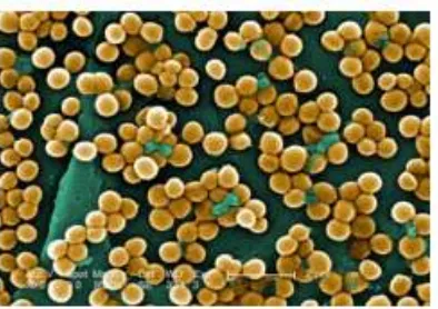 Gambar 1. Morfologi Staphylococcus aureus perbesaran 5000X  