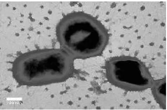 Gambar 2.4 Bakteri Porphyromonas gingivalis (Microbe Wiki, 