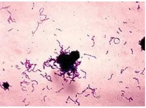 Gambar 2.1 Pewarnaan Gram bakteri Streptococcus mutans 
