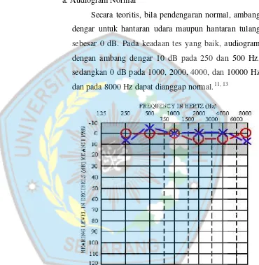 Gambar 2.7. Audiogram pendengaran normal1